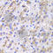 Cathepsin D antibody, A1594, ABclonal Technology, Immunohistochemistry paraffin image 