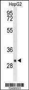 Iodothyronine Deiodinase 3 antibody, 63-991, ProSci, Western Blot image 