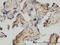 Exosome Component 8 antibody, LS-C133691, Lifespan Biosciences, Immunohistochemistry paraffin image 