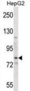 Smoothened, Frizzled Class Receptor antibody, abx028740, Abbexa, Western Blot image 