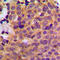 Casein Kinase 1 Alpha 1 antibody, LS-C354242, Lifespan Biosciences, Immunohistochemistry paraffin image 