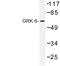 G Protein-Coupled Receptor Kinase 6 antibody, LS-C176764, Lifespan Biosciences, Western Blot image 