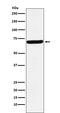 G3BP Stress Granule Assembly Factor 1 antibody, M02199, Boster Biological Technology, Western Blot image 