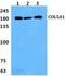 Collagen Type V Alpha 1 Chain antibody, LS-B13132, Lifespan Biosciences, Western Blot image 