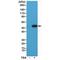 Tubulin Alpha 1b antibody, M08382-3, Boster Biological Technology, Western Blot image 