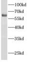 Acyl-CoA Synthetase Medium Chain Family Member 2A antibody, FNab00110, FineTest, Western Blot image 