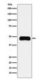 ETS Proto-Oncogene 1, Transcription Factor antibody, M00931-1, Boster Biological Technology, Western Blot image 