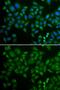 Sphingomyelin Phosphodiesterase 1 antibody, GTX64562, GeneTex, Immunofluorescence image 