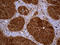 Thioredoxin Reductase 1 antibody, LS-C795926, Lifespan Biosciences, Immunohistochemistry paraffin image 