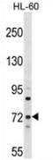 Myotubularin Related Protein 6 antibody, AP52768PU-N, Origene, Western Blot image 