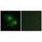 LIM Domain Kinase 2 antibody, A03511, Boster Biological Technology, Immunofluorescence image 