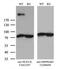 Nucleoporin 210 antibody, LS-C799927, Lifespan Biosciences, Western Blot image 