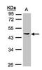Pregnancy Specific Beta-1-Glycoprotein 6 antibody, NBP1-32800, Novus Biologicals, Western Blot image 