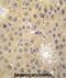 Sterol O-Acyltransferase 1 antibody, abx033477, Abbexa, Immunohistochemistry frozen image 