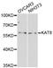 Lysine Acetyltransferase 8 antibody, STJ24282, St John