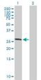 Ankyrin Repeat And SOCS Box Containing 7 antibody, H00140460-B01P, Novus Biologicals, Western Blot image 