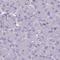 Tripartite Motif Containing 39 antibody, HPA051120, Atlas Antibodies, Immunohistochemistry paraffin image 