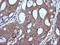 Mitogen-Activated Protein Kinase Kinase 1 antibody, LS-C338033, Lifespan Biosciences, Immunohistochemistry paraffin image 