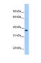 ST3 Beta-Galactoside Alpha-2,3-Sialyltransferase 2 antibody, NBP1-69570, Novus Biologicals, Western Blot image 