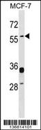 Syncytin antibody, 58-894, ProSci, Western Blot image 