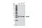 MYD88 Innate Immune Signal Transduction Adaptor antibody, 4283S, Cell Signaling Technology, Western Blot image 