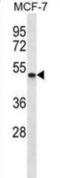 SMYD Family Member 5 antibody, abx030995, Abbexa, Western Blot image 