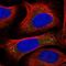 Voltage Dependent Anion Channel 1 antibody, NBP2-38163, Novus Biologicals, Immunocytochemistry image 