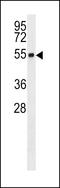 Ring Finger Protein 26 antibody, LS-C158876, Lifespan Biosciences, Western Blot image 