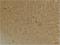 Gamma-Aminobutyric Acid Type B Receptor Subunit 2 antibody, A03830, Boster Biological Technology, Immunohistochemistry paraffin image 