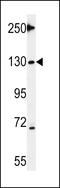 Tankyrase 2 antibody, 61-877, ProSci, Western Blot image 