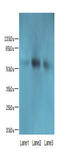 MINDY Lysine 48 Deubiquitinase 1 antibody, A66742-100, Epigentek, Western Blot image 