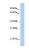 Sulfotransferase Family 1C Member 2 antibody, NBP1-53102, Novus Biologicals, Western Blot image 