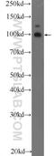 Teashirt Zinc Finger Homeobox 3 antibody, 25018-1-AP, Proteintech Group, Western Blot image 