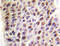 Q92993-3 antibody, AP20318PU-N, Origene, Immunohistochemistry paraffin image 