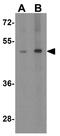 TRAF family member-associated NF-kappa-B activator antibody, GTX31740, GeneTex, Western Blot image 