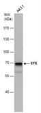 Spleen Associated Tyrosine Kinase antibody, NBP1-32945, Novus Biologicals, Western Blot image 