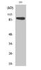 Ribosomal Protein S6 Kinase A1 antibody, STJ95547, St John