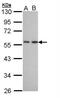 Dipeptidyl Peptidase 7 antibody, NBP1-32875, Novus Biologicals, Western Blot image 