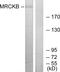 CDC42 Binding Protein Kinase Beta antibody, PA5-38838, Invitrogen Antibodies, Western Blot image 