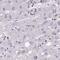 Chromosome Segregation 1 Like antibody, NBP2-38384, Novus Biologicals, Immunohistochemistry paraffin image 