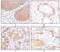 Keratin 5 antibody, MA5-15347, Invitrogen Antibodies, Immunohistochemistry paraffin image 