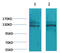 Calcium Sensing Receptor antibody, STJ97414, St John
