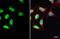 SET Domain Containing 2, Histone Lysine Methyltransferase antibody, GTX127905, GeneTex, Immunocytochemistry image 