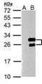 Twist Family BHLH Transcription Factor 1 antibody, GTX100621, GeneTex, Western Blot image 