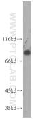 MDM4 Regulator Of P53 antibody, 17914-1-AP, Proteintech Group, Western Blot image 