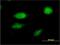 Forkhead Box C2 antibody, H00002303-M02, Novus Biologicals, Immunocytochemistry image 