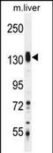 SAM And SH3 Domain Containing 1 antibody, PA5-48234, Invitrogen Antibodies, Western Blot image 