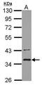 BRCA1/BRCA2-Containing Complex Subunit 3 antibody, PA5-29002, Invitrogen Antibodies, Western Blot image 