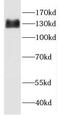 GEM Interacting Protein antibody, FNab03525, FineTest, Western Blot image 