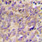 Protein Tyrosine Kinase 2 Beta antibody, LS-C358840, Lifespan Biosciences, Immunohistochemistry paraffin image 